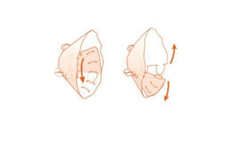 Műtéti gallér Neocol 30 cm   1 db