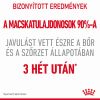 Royal Canin Hair & Skin Care - száraz táp felnőtt macskák részére a szebb szőrzetért és az egészséges bőrért  10 kg